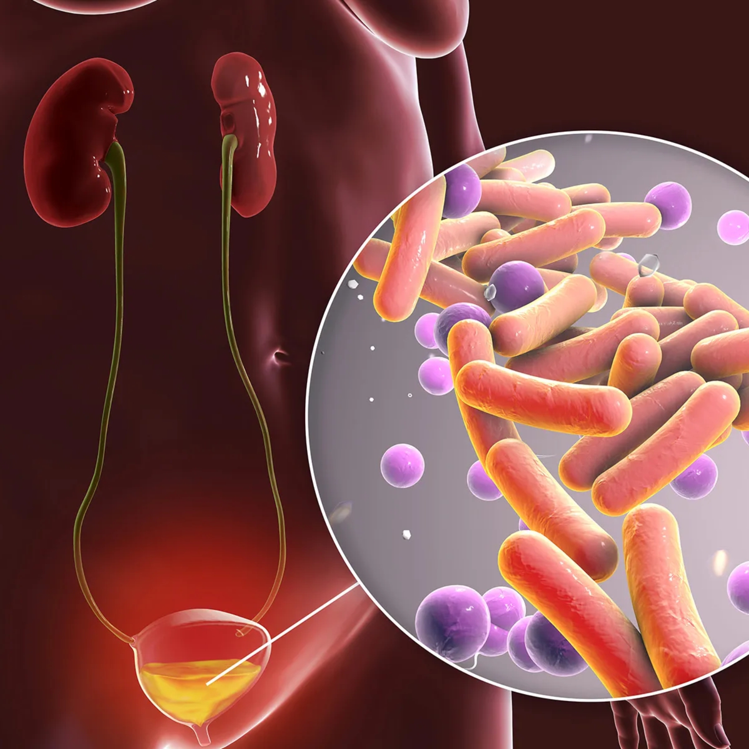 Ayurvedic treatment for  Urinary Tract Infection 